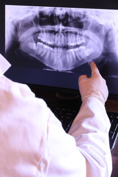 Best Emergency Tooth Extraction in Sharon, TN